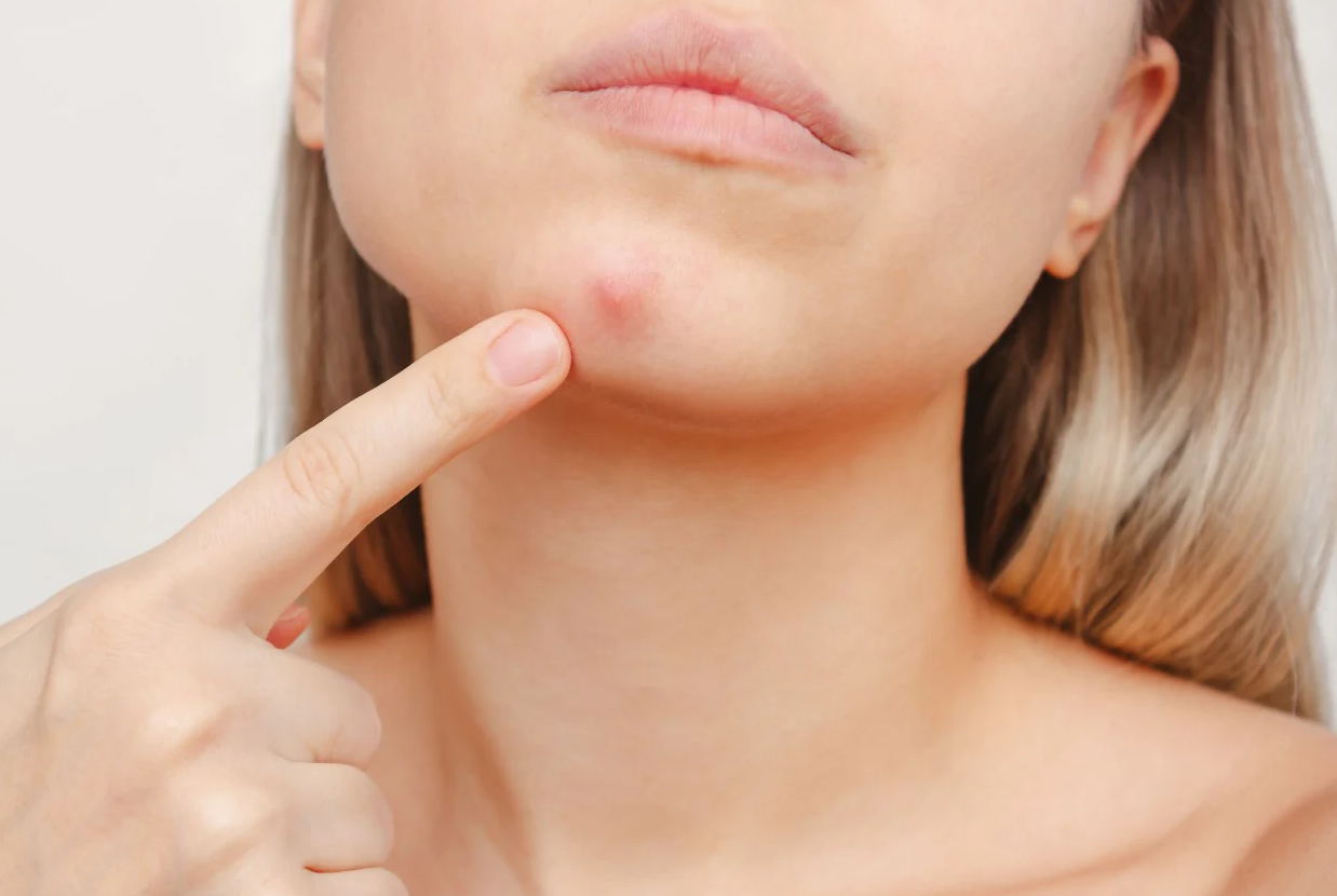Red Spots on the Skin: Causes, Symptoms, and Care