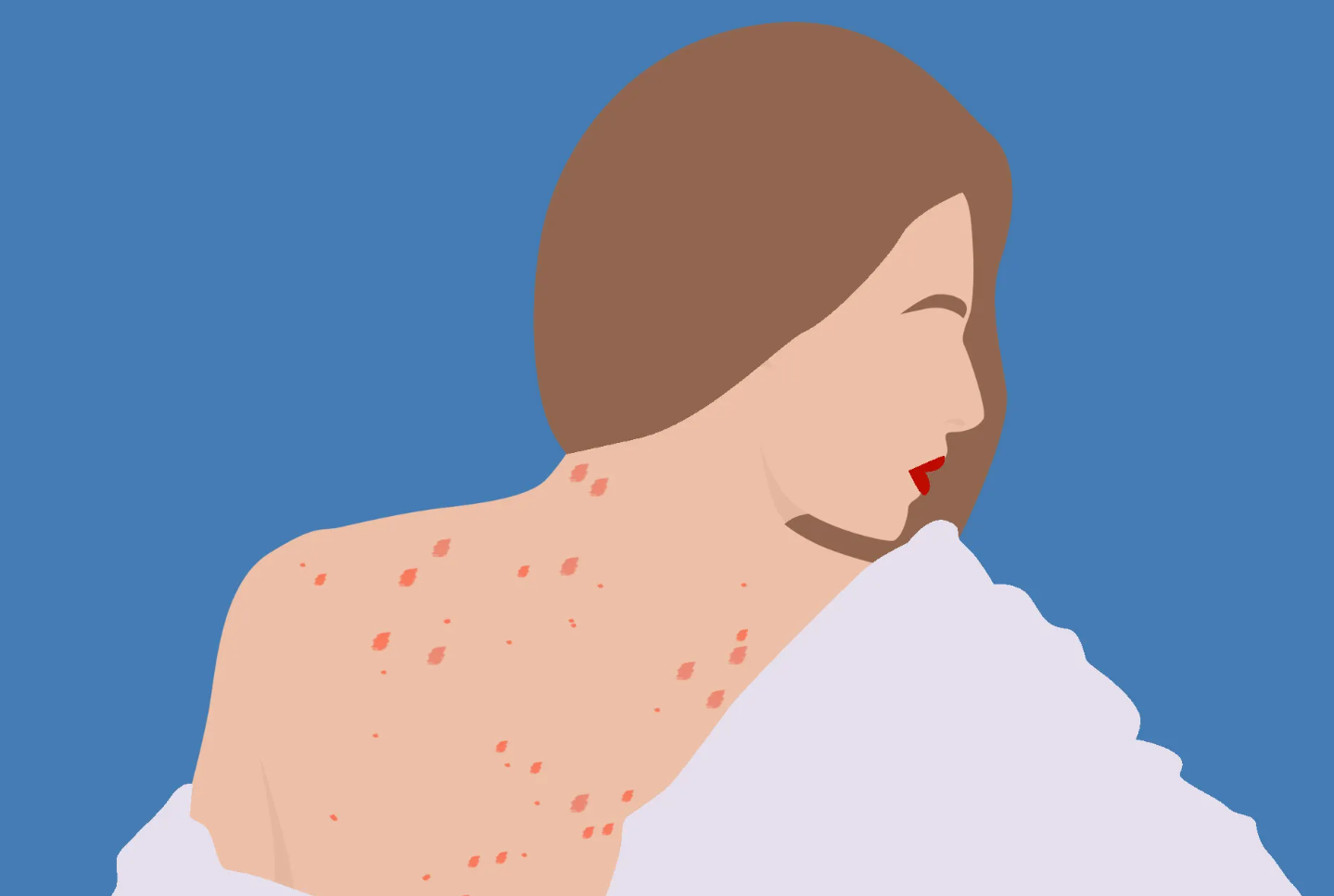 Red Spots on the Skin kyiv