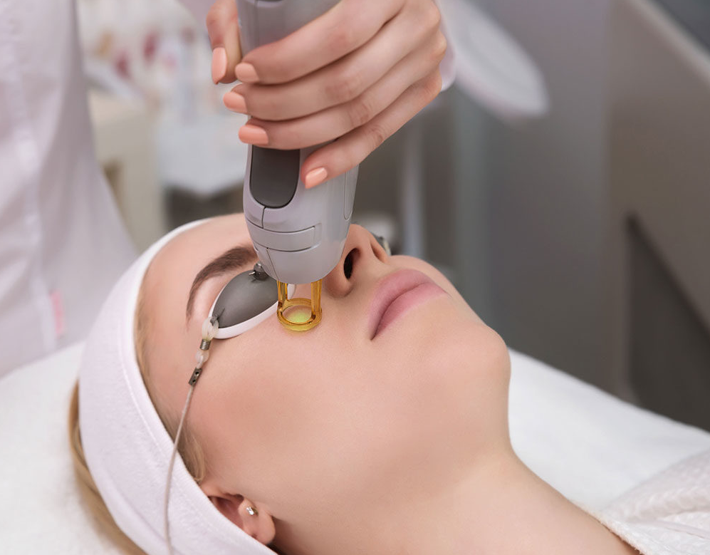 Laser facial resurfacing Kyiv
