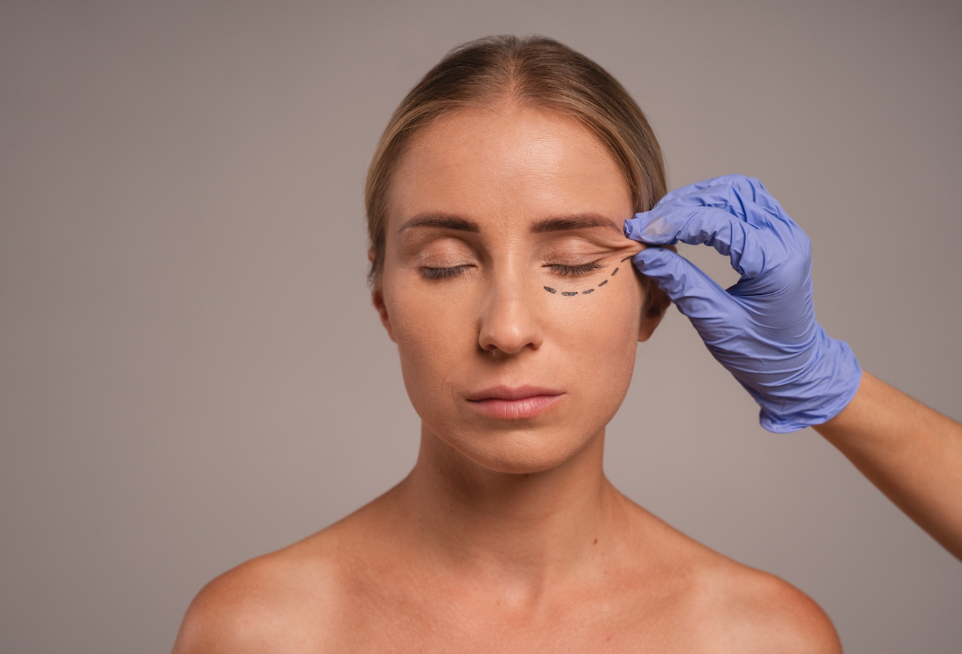 Blepharoplasty and Facial Aging: What to Know Before Considering Eyelid Surgery